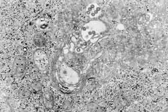 科学家发现超强抗体,科学家研究病毒科普小知识
