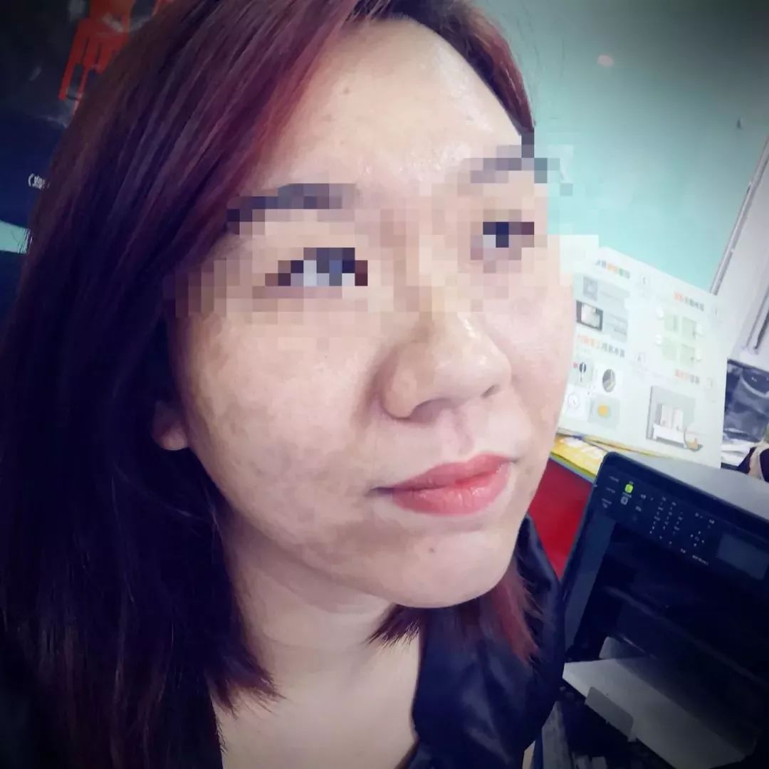 美容变毁容真实事件,美容变毁容构成医疗事件