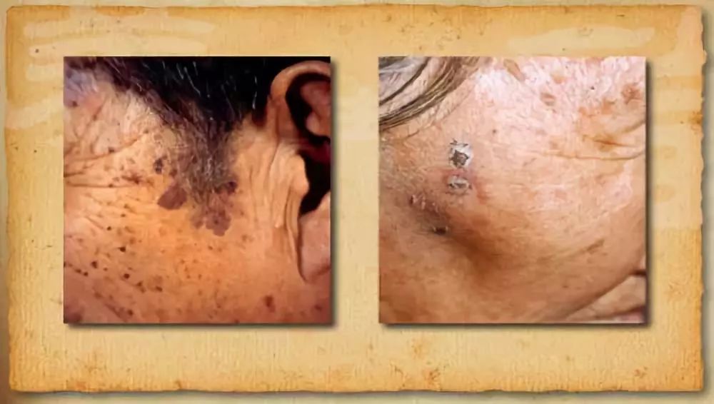 脱发属于什么问题,脱发是什么原因造成中老年