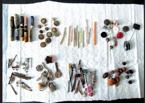 惊险！温州一婴儿连续几天吐血竟是误食了一根针！