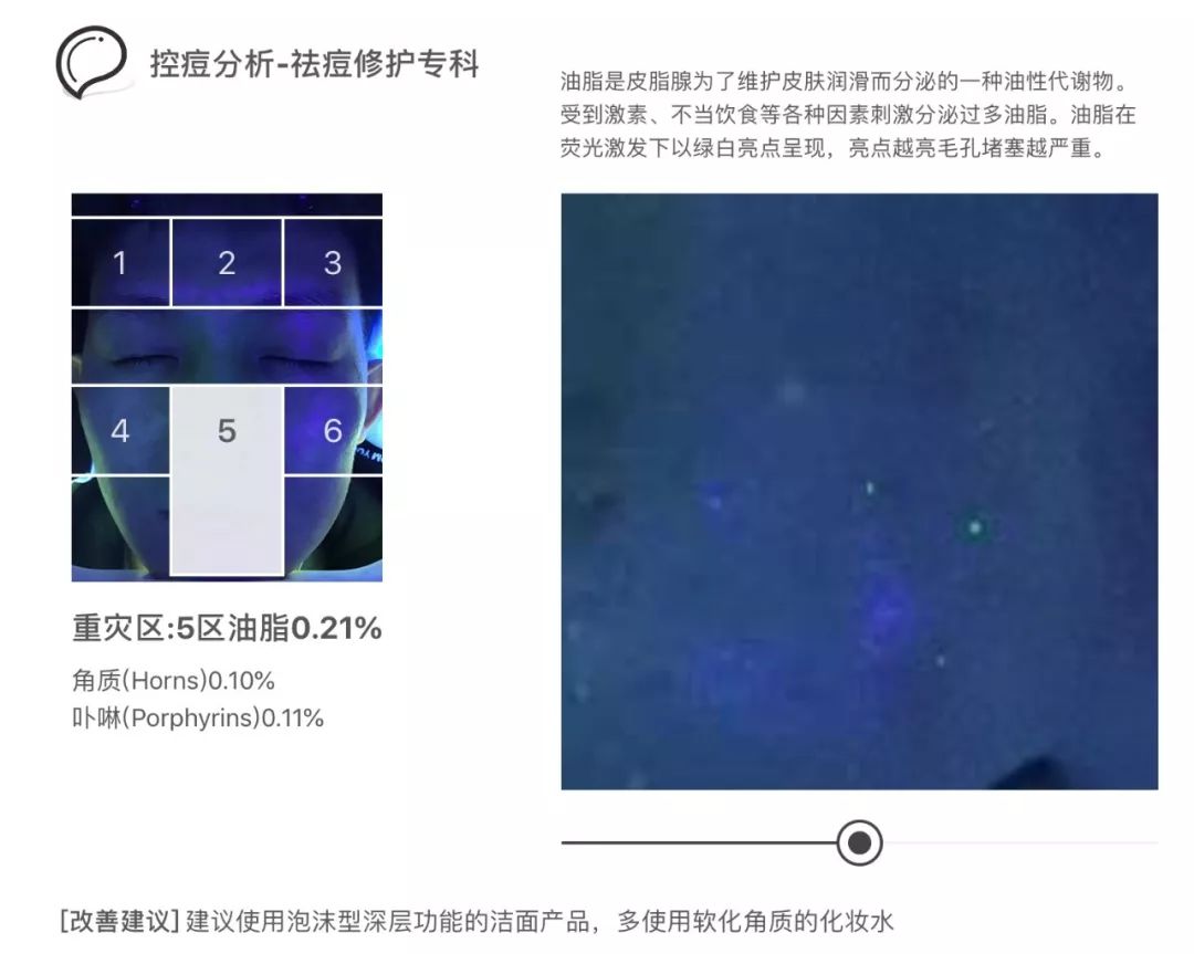 灏忚寕鑲岃瘖瀹よˉ姘村悧,灏忚寕鑲岃瘖瀹ゅ埌搴曟湁澶氬己