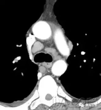 胸部解剖及常见疾病影像表现,胸部影像学基础知识