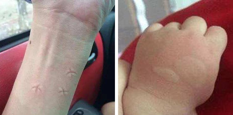 很好用的蚊子药膏 (最近很流行的蚊子膏)