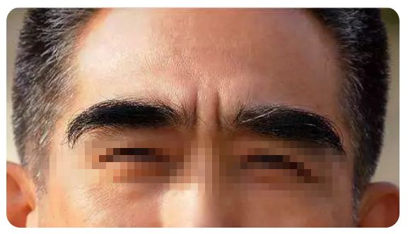 从眉毛看出疾病的征兆,小孩掉眉毛可能是大病预兆