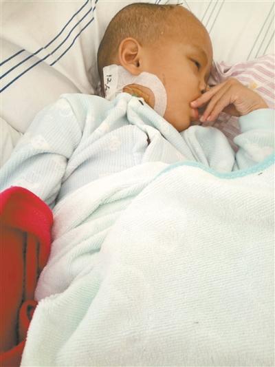 14岁男孩患癌暴瘦100斤,5岁小孩患脑瘤做手术的成功率