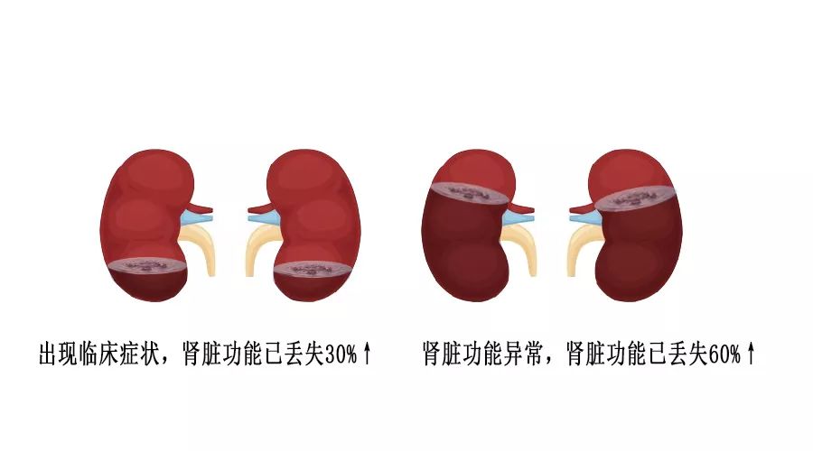 科普肾脏,医学科普出汗和肾脏关系