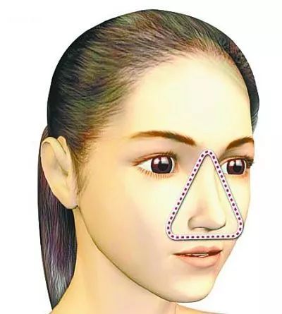 为什么挤痘痘会挤进icu,挤掉痘痘后留了个洞