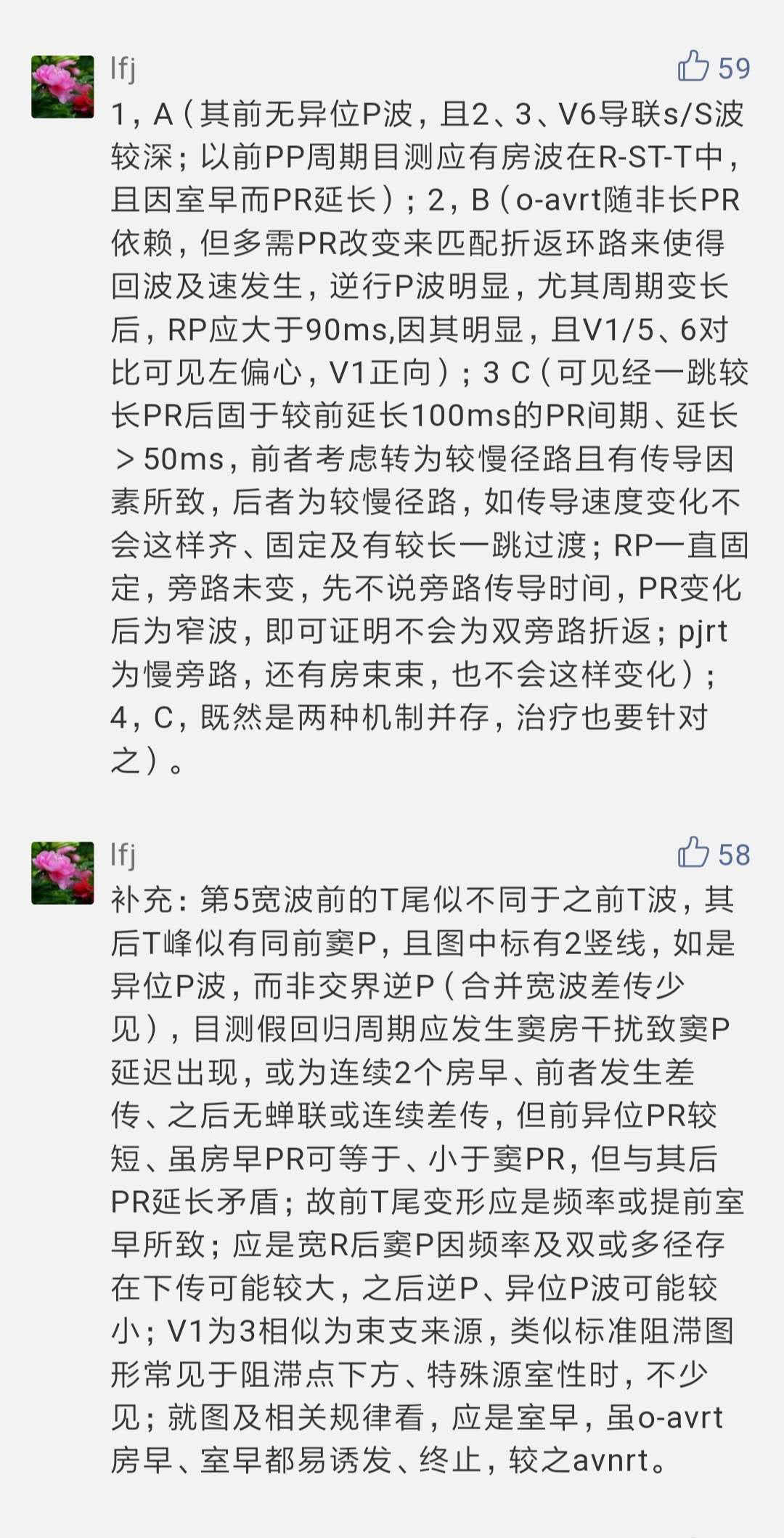 心电图显示窦性心动过速怎么办,一张心电图可以诊断心脏过缓吗