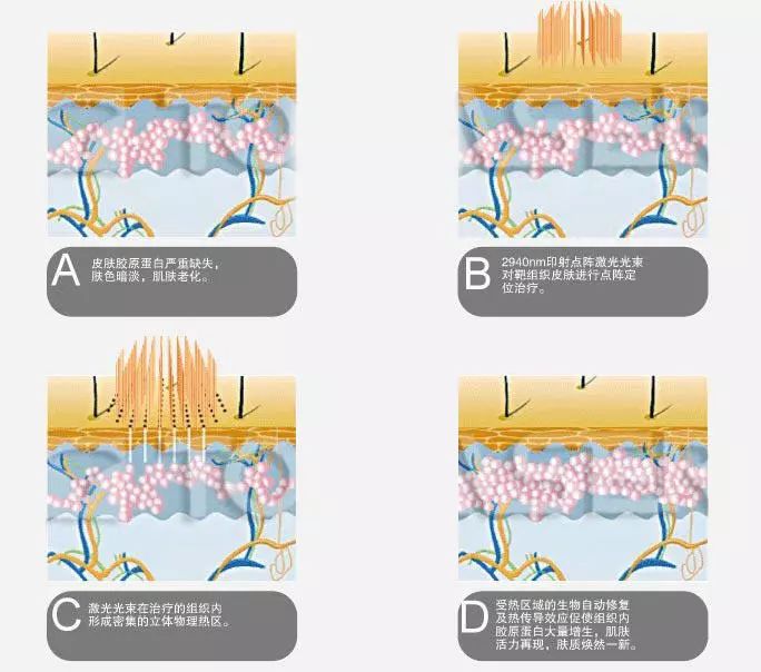 要你好看谐音,要你好看粤语