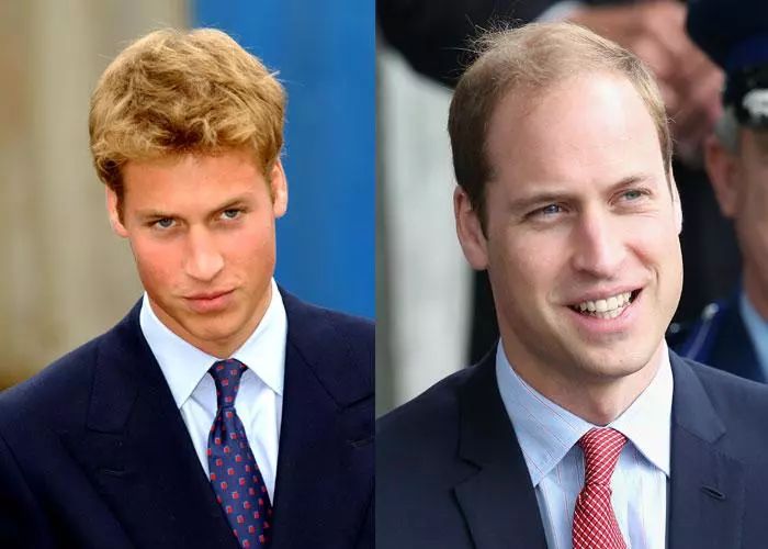 日本防脱生发增发密发育发液,脱发救星防脱育发洗发水