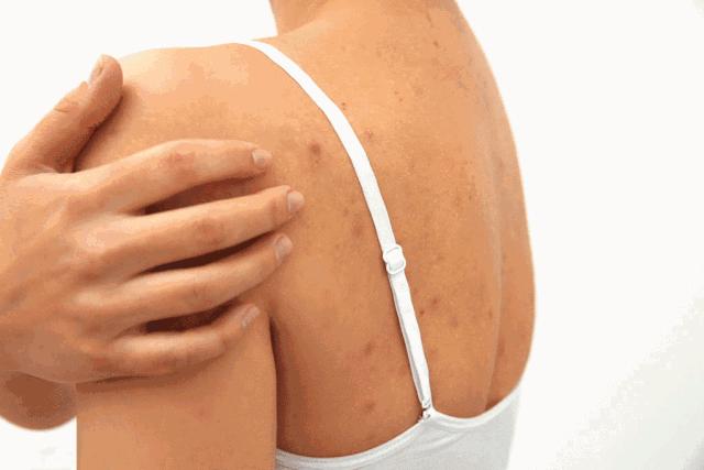 无痛搓泥|日系变态搓澡巾！轻轻搓一搓，泥条劈里啪啦的掉