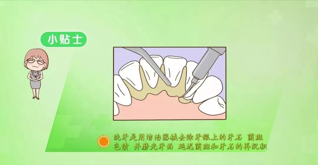 洗牙的危害与好处,洗牙对牙齿的影响