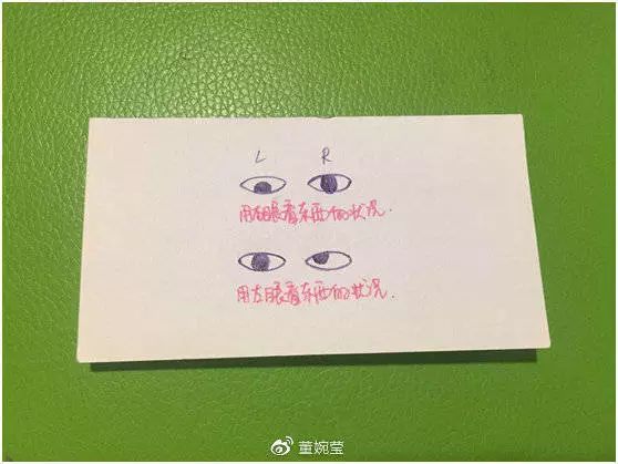 华西整形科斜视,华西眼科斜视手术多少钱