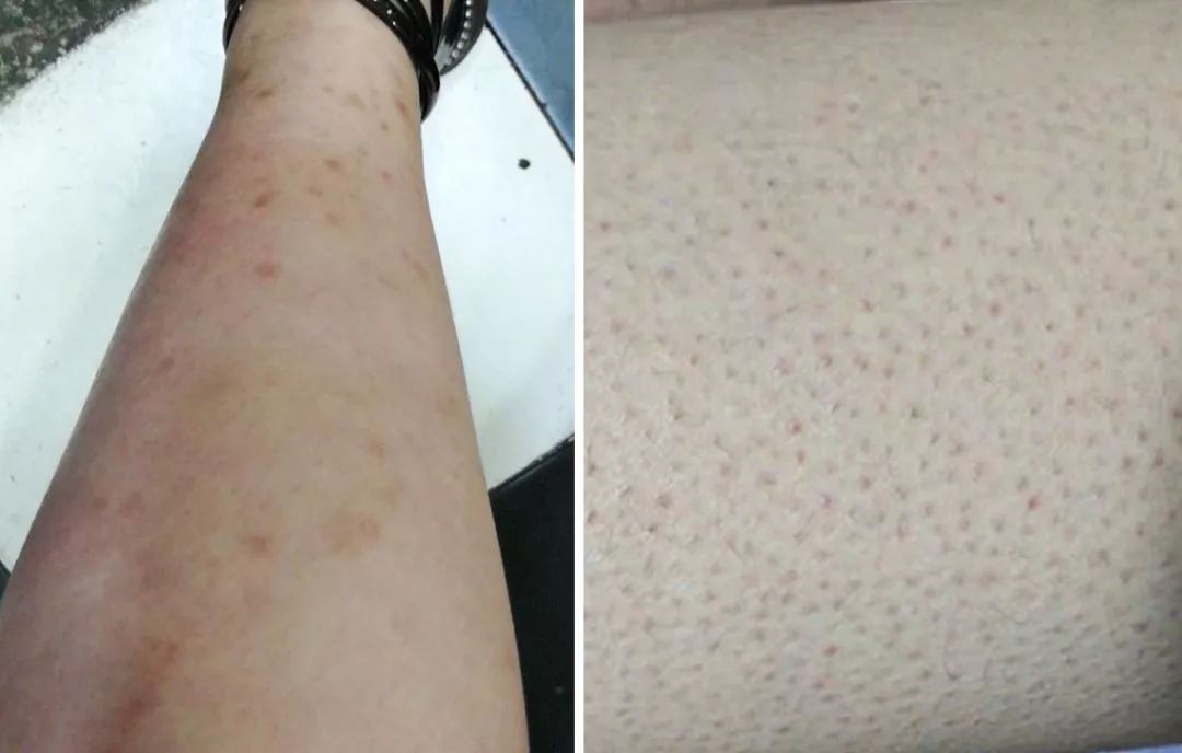 裸感美腿|1瓶=20双*袜丝**！3秒喷出“裸感”大美腿！隐形毛孔、鸡皮肤！短裙绝配