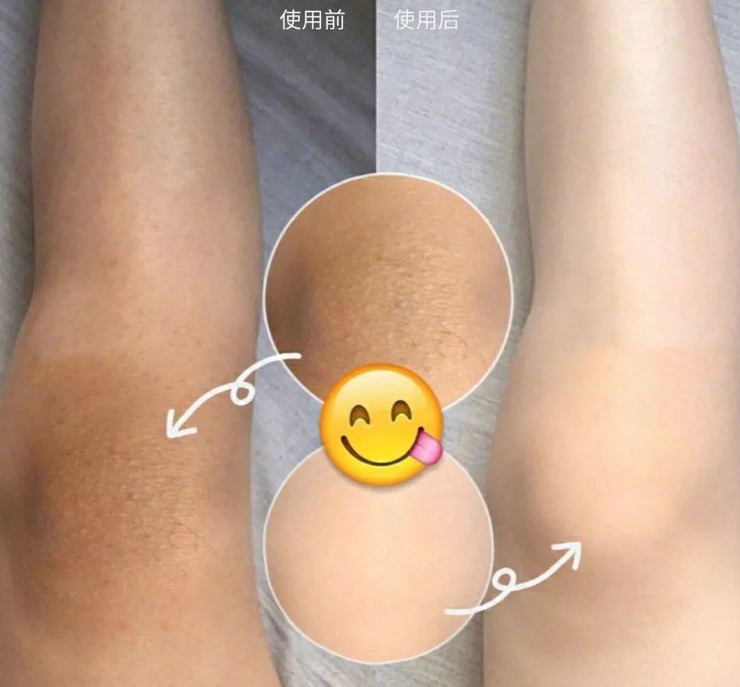 裸感美腿|1瓶=20双*袜丝**！3秒喷出“裸感”大美腿！隐形毛孔、鸡皮肤！短裙绝配