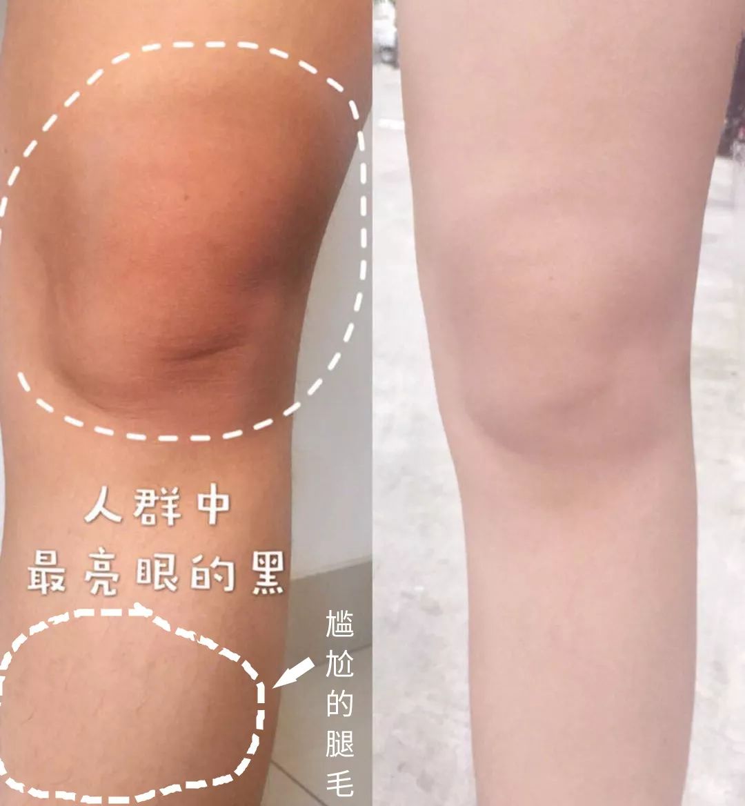 裸感美腿|1瓶=20双*袜丝**！3秒喷出“裸感”大美腿！隐形毛孔、鸡皮肤！短裙绝配