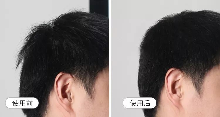 针对油脂性头屑的皂,去头皮屑黑皂