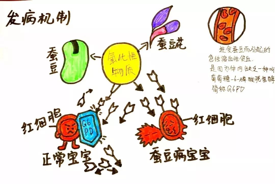 什么是蚕豆病又称什么病,啥是蚕豆病呀