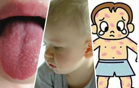 紧急提醒这些疾病已进入高发期,家长注意这种病进入高发期