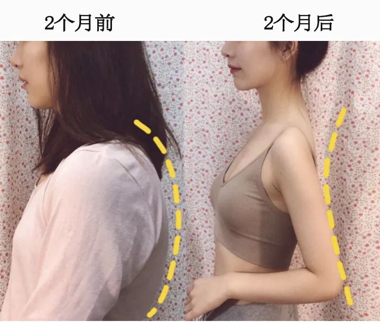 改善含胸驼背的最有效方法10分钟,改善含胸驼背的最有效方法完整版