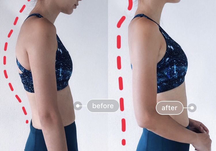 含胸驼背最损气质手把手教你纠正,含胸驼背如何改善提升气质