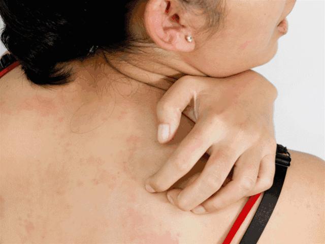 为什么能从鼻头上挤出白色的东西,鼻子挤出来的白丝是什么