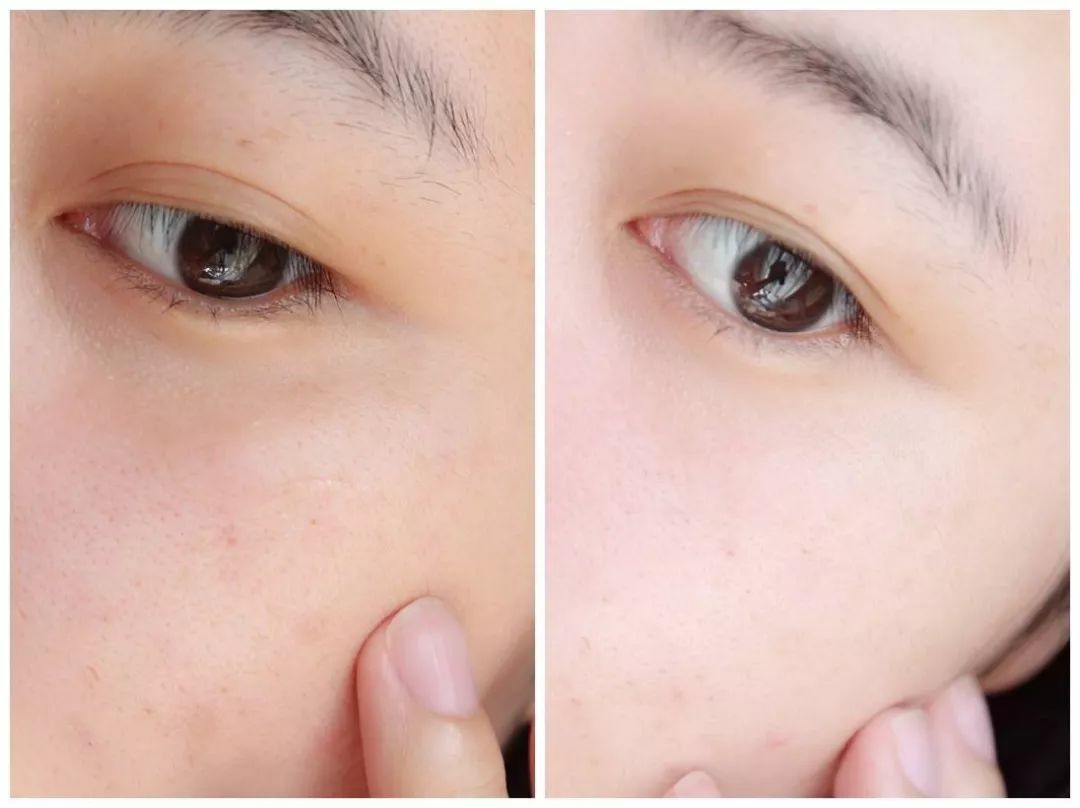 内调养颜原来真的很重要,内调有多重要