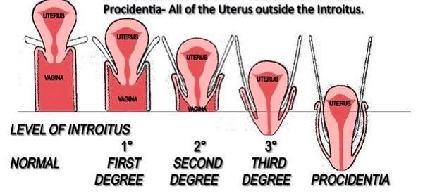 没有哪个女人能“笑”着走出这段时光，所有完美人设都是假装。