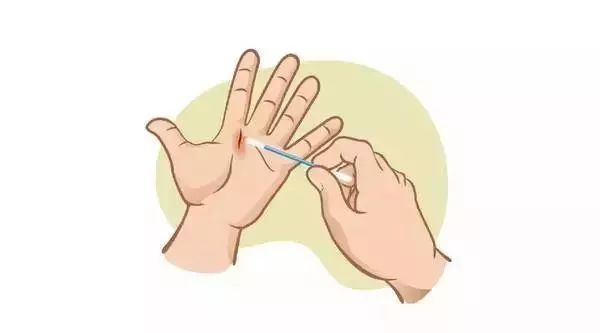 超实用的家庭急救指南,最实用的家庭急救