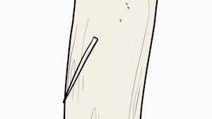 凶险！一口气喝完鱼汤后胸口刺痛！没想到竟需要8个科室10多位专家联手……