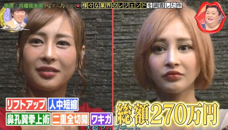 日本整形医生石原里美,石原里美脸部变美技巧