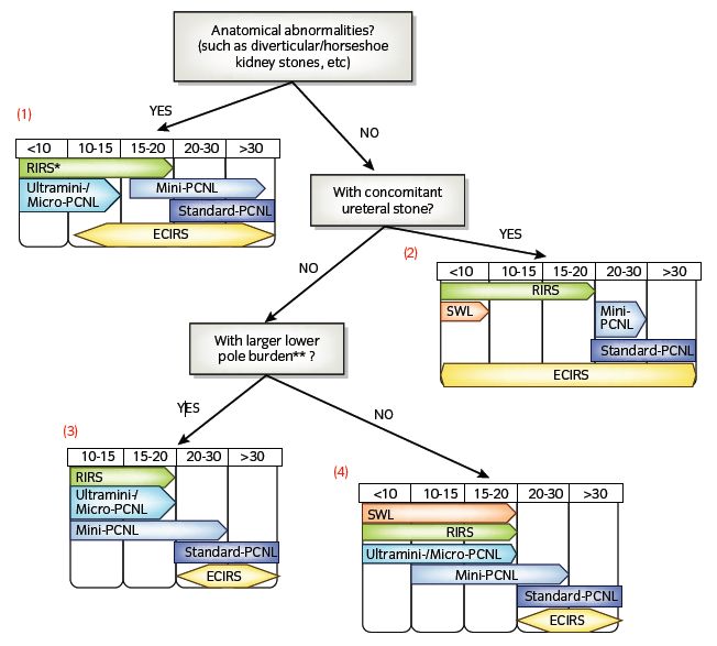 最新泌尿结石处理方案,全国泌尿系结石治疗最好医院