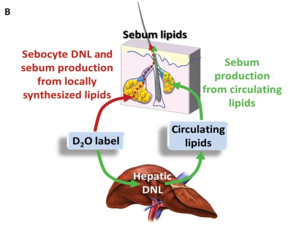 《科学》子刊：降糖又祛痘是什么道理？科学家意外发现一款糖尿病药物可以控制皮肤出油，有助于治疗*疮痤**|科学大发现