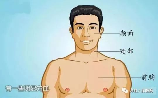 健康科普肾综合征出血热知多少,健康知识科普肾衰竭的症状表现