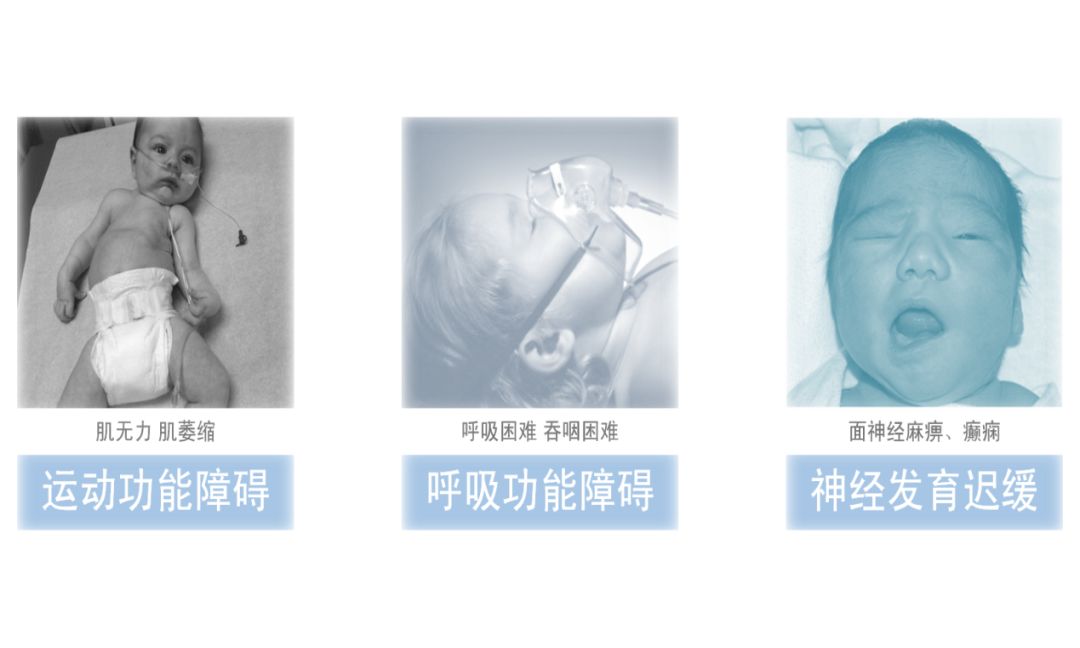 手足口病疫苗是预防终身吗,ev71手足口病疫苗潮州哪里有得打