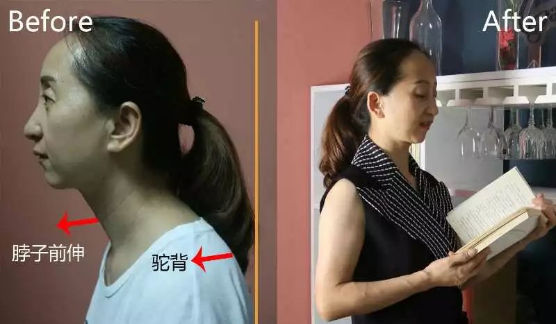 天鹅颈锁骨怎么练快速明显,天鹅颈的修炼方法视频