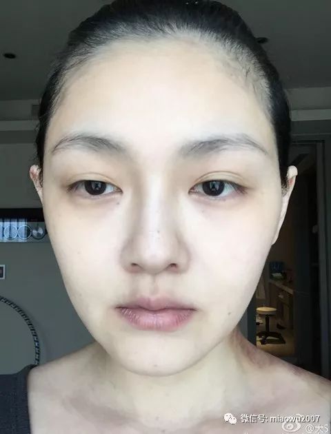 面膜其实没必要用,为什么少用面膜