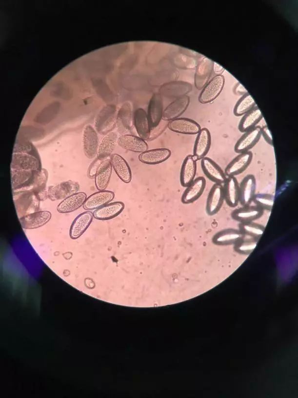 四岁女宝宝说小便地方痒和痛,四岁女宝宝说小便地方痒怎么办