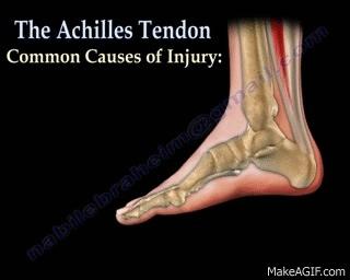 杜兰特汤普森跟腱断裂影响有多大,杜兰特跟腱断裂为什么还那么厉害