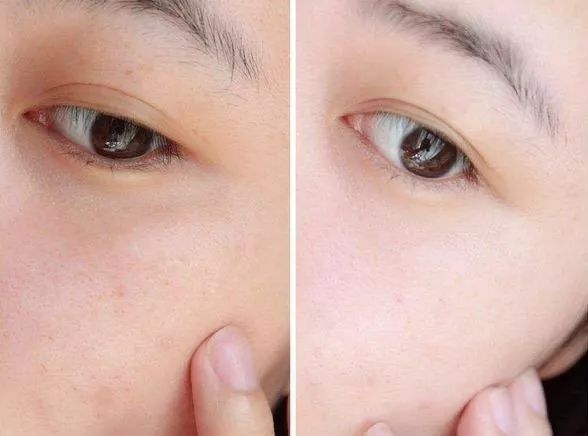 可以变白的维c推荐,维c既美白又抗老