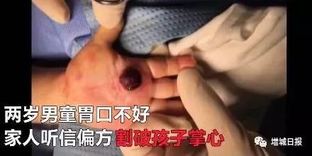 一男子用民间偏方治病险送命！这些偏方都是血淋淋的教训，千万别信