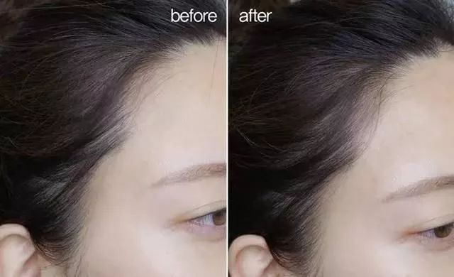 听说90后已经开始脱发了,听说第一批90后已经开始脱发了