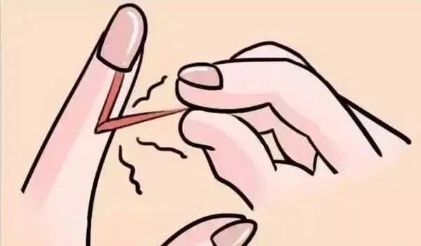 血泪教训的十个方法,手上长倒刺别乱撕这样做更靠谱