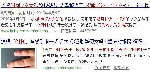 血泪教训的十个方法,手上长倒刺别乱撕这样做更靠谱