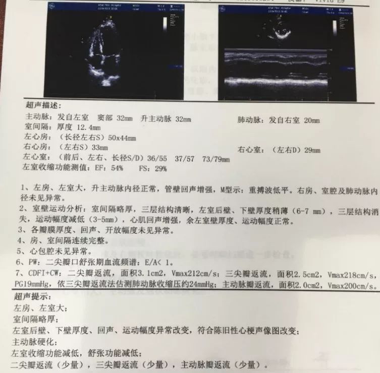sglt-2抑制剂治疗心衰指南,临床心衰治疗药