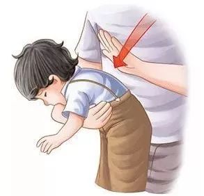 小儿气管异物急救方法视频,小儿气管异物排出三种方法