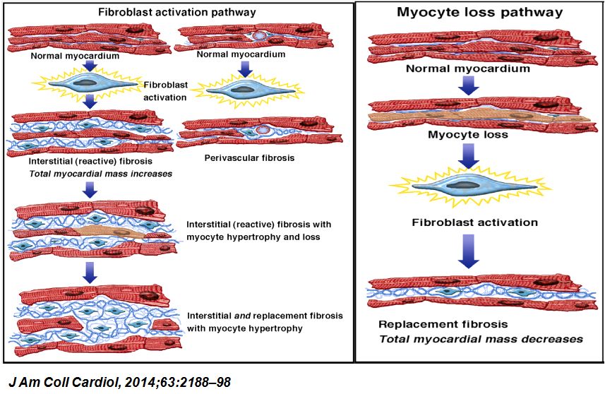 「2019CIHFC」张运教授:ADAM17—糖尿病性心肌病干预的新靶点