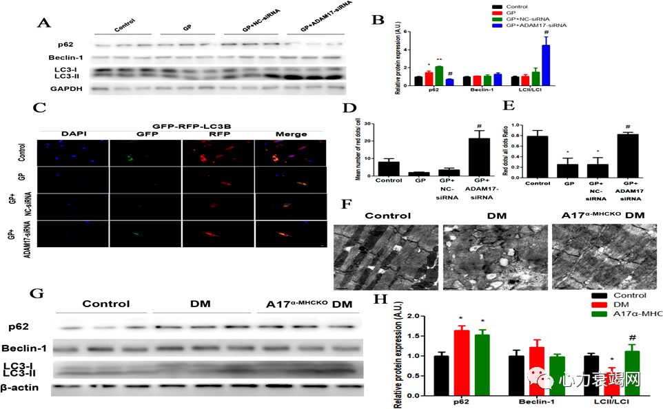 「2019CIHFC」张运教授:ADAM17—糖尿病性心肌病干预的新靶点