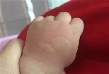 最好的修复膏,亲测好用的修护万能膏