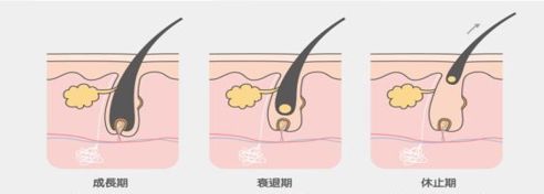 脱发有人治好吗,脱发治好了还能长出新发吗